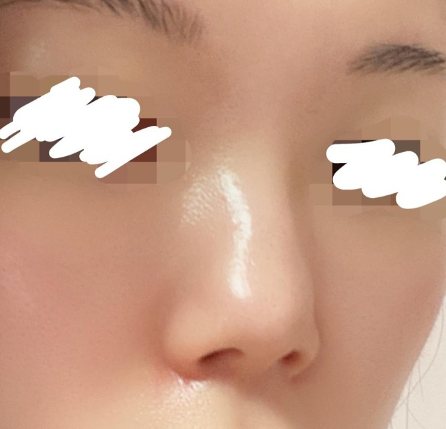 [Хамрын] Ём Исс - Хамар