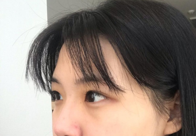 [Нүд] Унгангөнг - Давхар зовхи (байгалийн наалт), дээд зовхины зүслэг