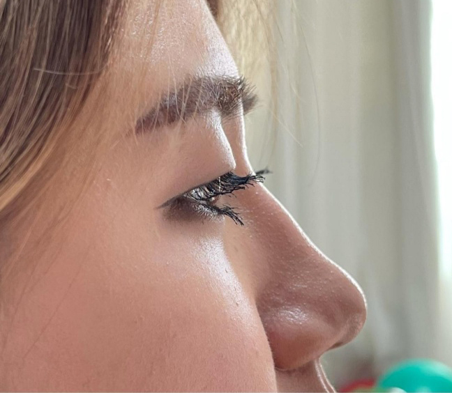 [Хамрын] Куингкуингкуинг - Хамар