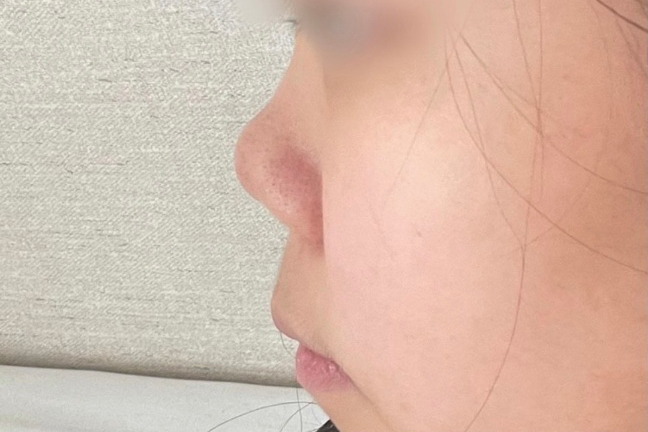 [Хамрын] Жун Жи Хён 2 - Хамрын нуруу