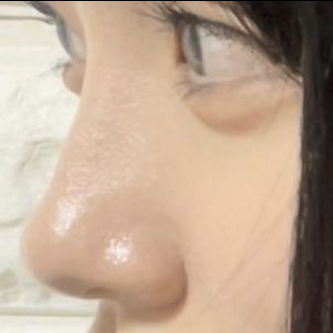 [Хамрын] Дахин дахин 1 - Хамар