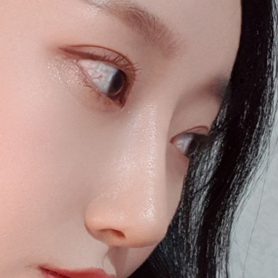 [Хамрын мэс засал] Оливиа - Хамар