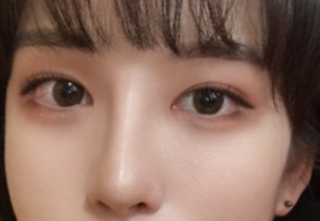 [Нүд] Цагаан шош - Нүд, хамар, нүүрний хэлбэр засах 3 төрөл, дух өргөх