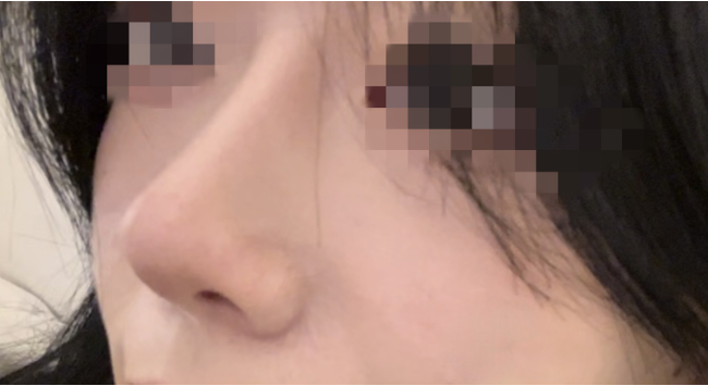 [Хамрын] Шилэн хэлтэрхий - Хамар