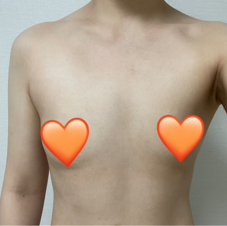 [Цээж] Сентри - Цээж