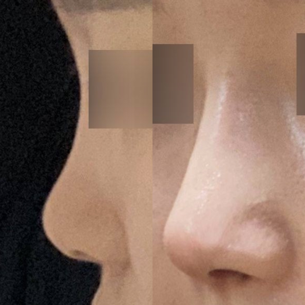 Хамарны анхны хагалгаагаа Weavers-т хийлгэсэн