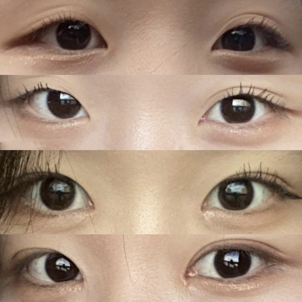 Би нүдний мэс засал хийлгэсэн :)