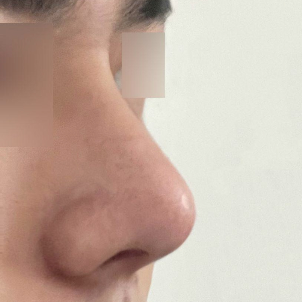 Шим Жон Хван эмчид хагалгаанд ороод 1 сар боллоо.