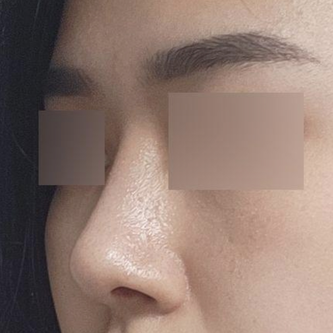 Жижигхэн булцгар хамар засч, 2 сар боллоо!