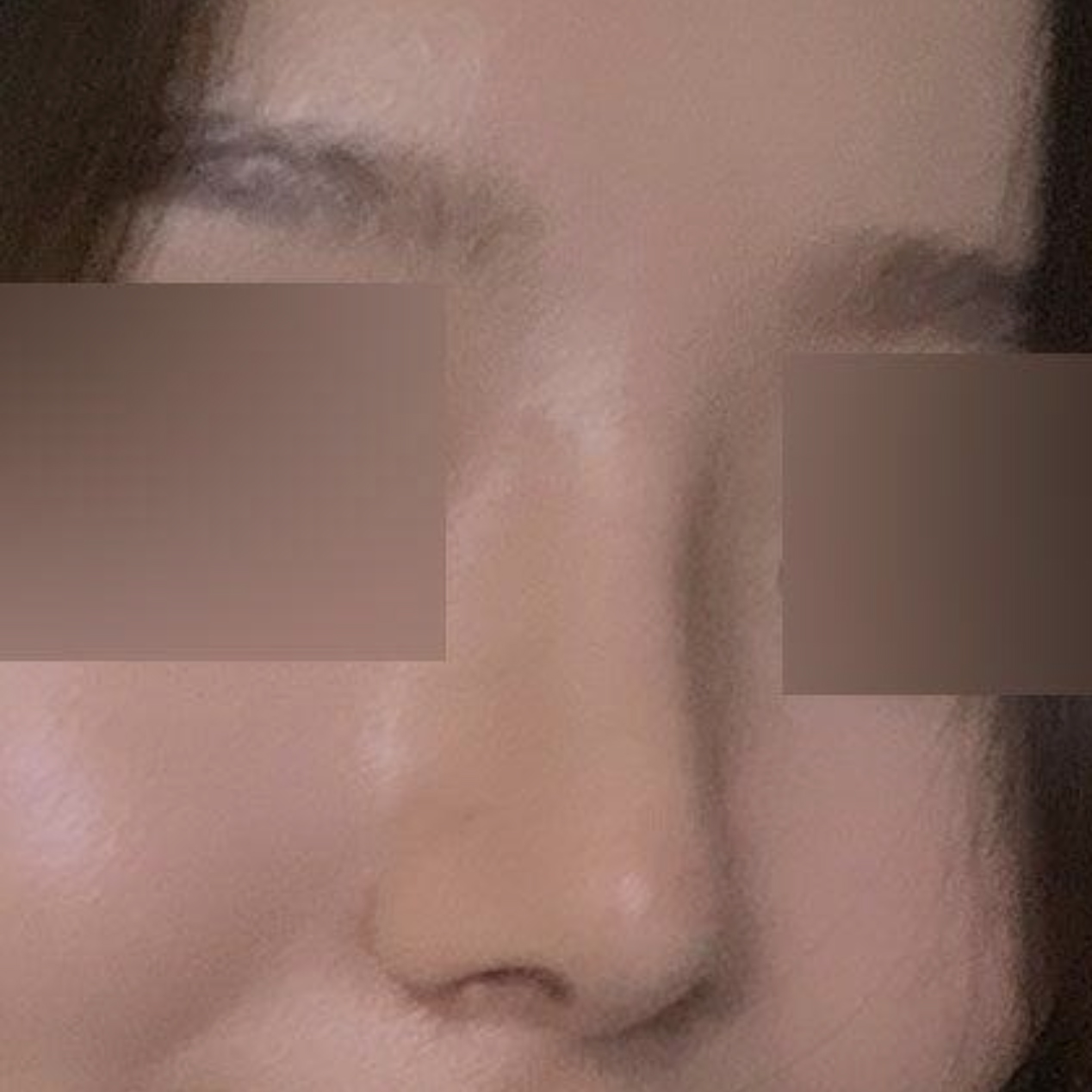 Вийверст мэс засал хийлгэснээс хойш яг 2 сар боллоо