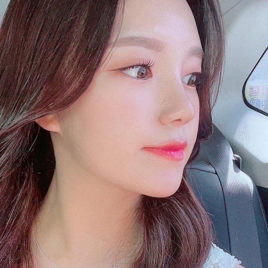 Вийвэрс гоо сайхны мэс заслын эмнэлэгт хамрын мэс засалд ороод 3 сар болжээ.