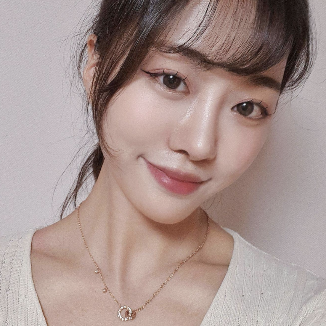 Вийвэрс гоо сайхны мэс заслын эмнэлэгт хамрын дахин мэс засал хийлгэснээс хойш гурван сар боллоо!