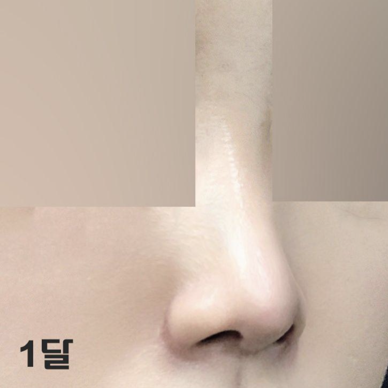 Нэг сар болоход хавагнах нь бүр ч их арилж байгаа юм шиг байна.