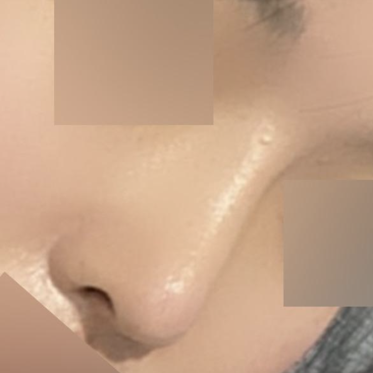 Хамрын мэс заслын дараах сэтгэгдэлээ үлдээж байна