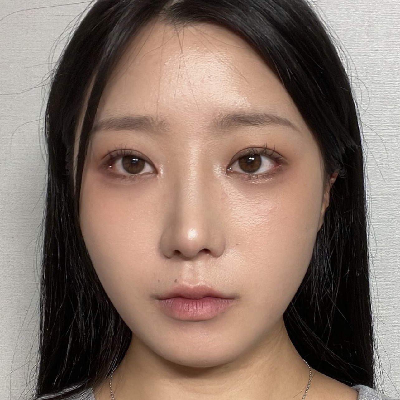 Мэс засал хийлгэснээс хойш сар гаруй болж байна~