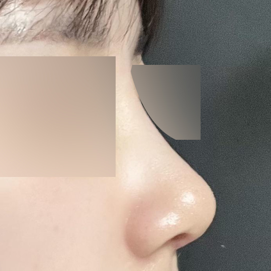 Миний цогцолбор байсан хамар маань сайхан болсон!