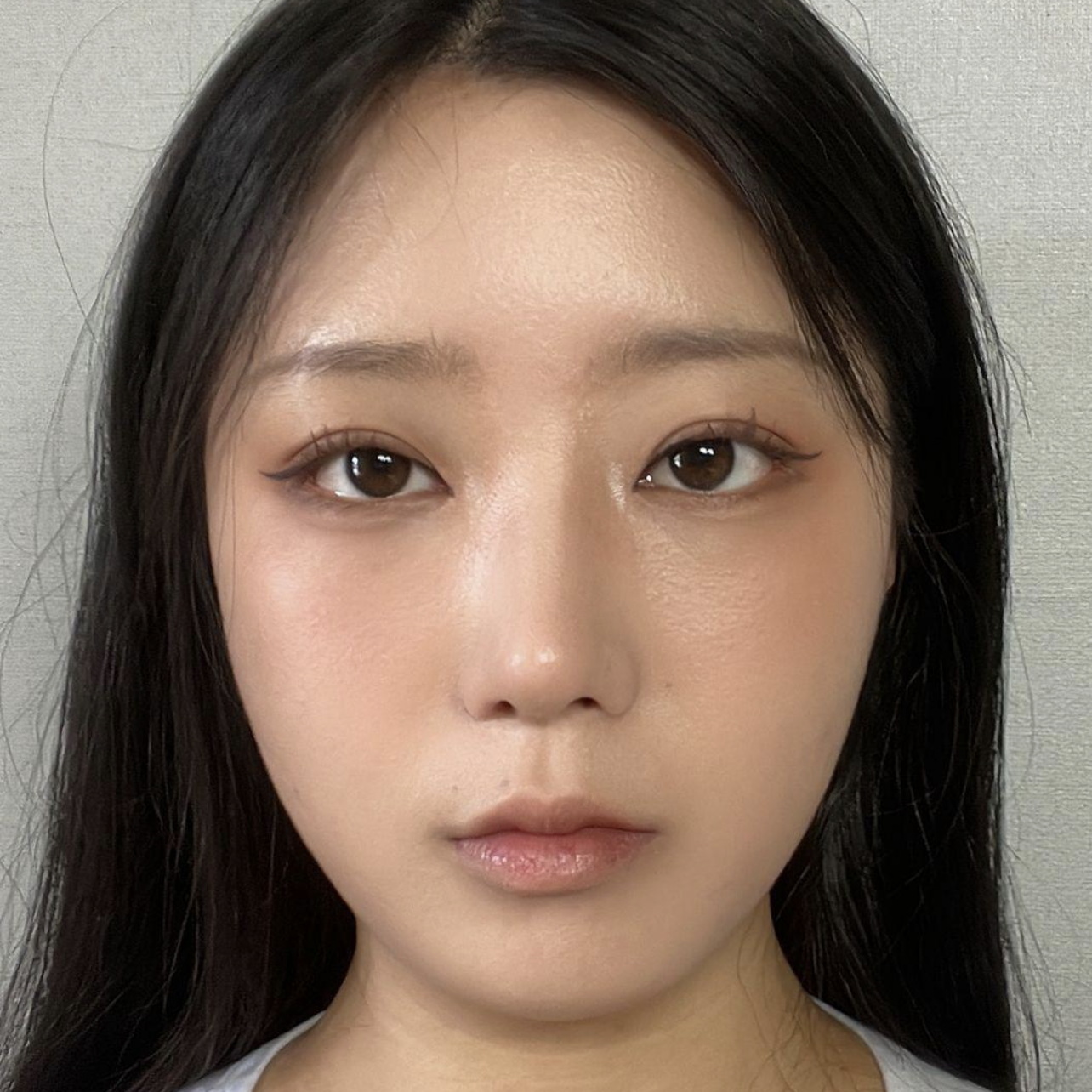 Хоёр сарын дараа нүд маань улам бүр байгалиараа гоё болж, байрлал нь ч сайжирсан байна.