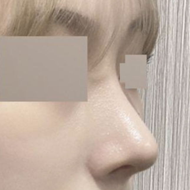 Мэс засал хийлгээд 2 сар болж байна даа!!