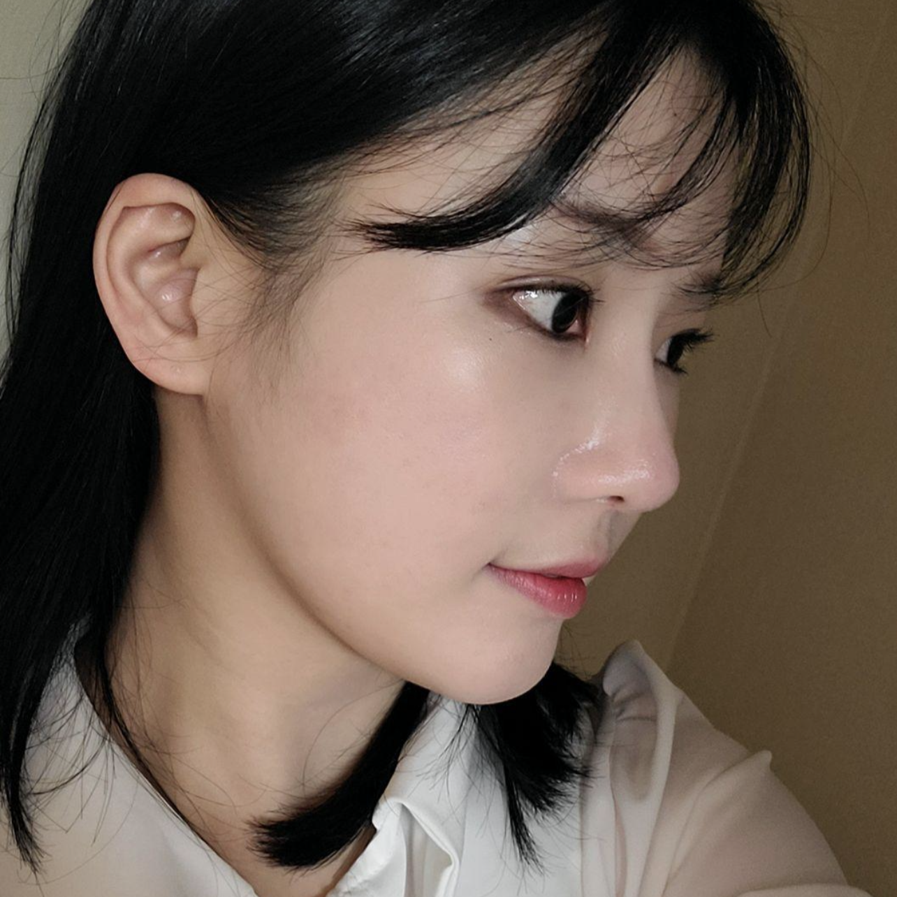 Вийверс гоо сайхны мэс заслын эмнэлэгт хамар, нүдний дахин мэс засал хийлгэснээс хойш 2 сар болжээ