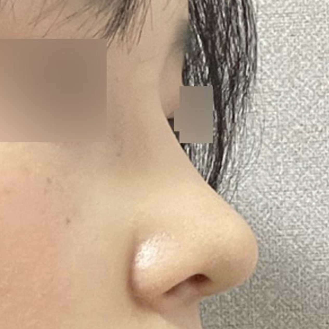 Мэс ажиллагаа үнэхээр сайн болсон болохоор би маш их сэтгэл хангалуун байна!