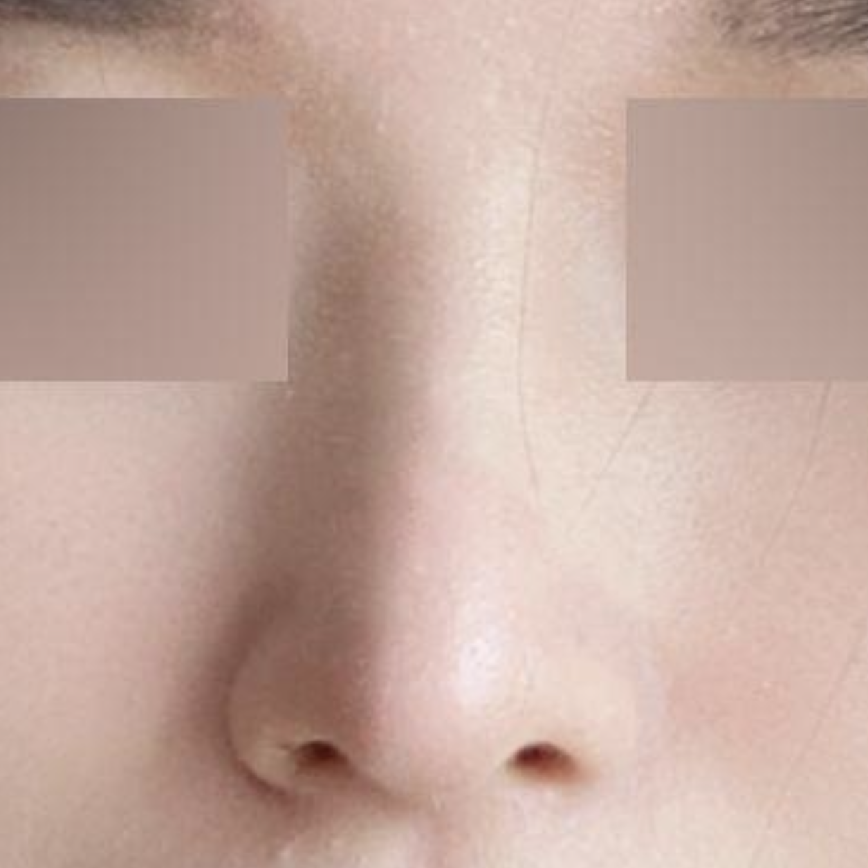 Хамрын мэс засал хийлгэснээс хойш 6 сар өнгөрчээ