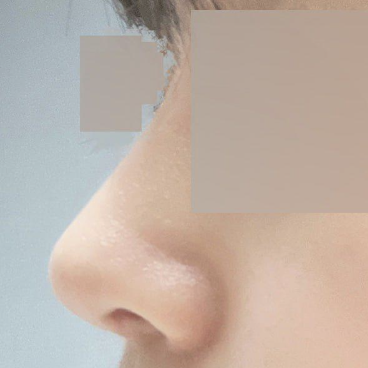 Вийвэрс гоо сайхны эмнэлэгт хамрын хагалгаанд ороод хоёр сар болжээ