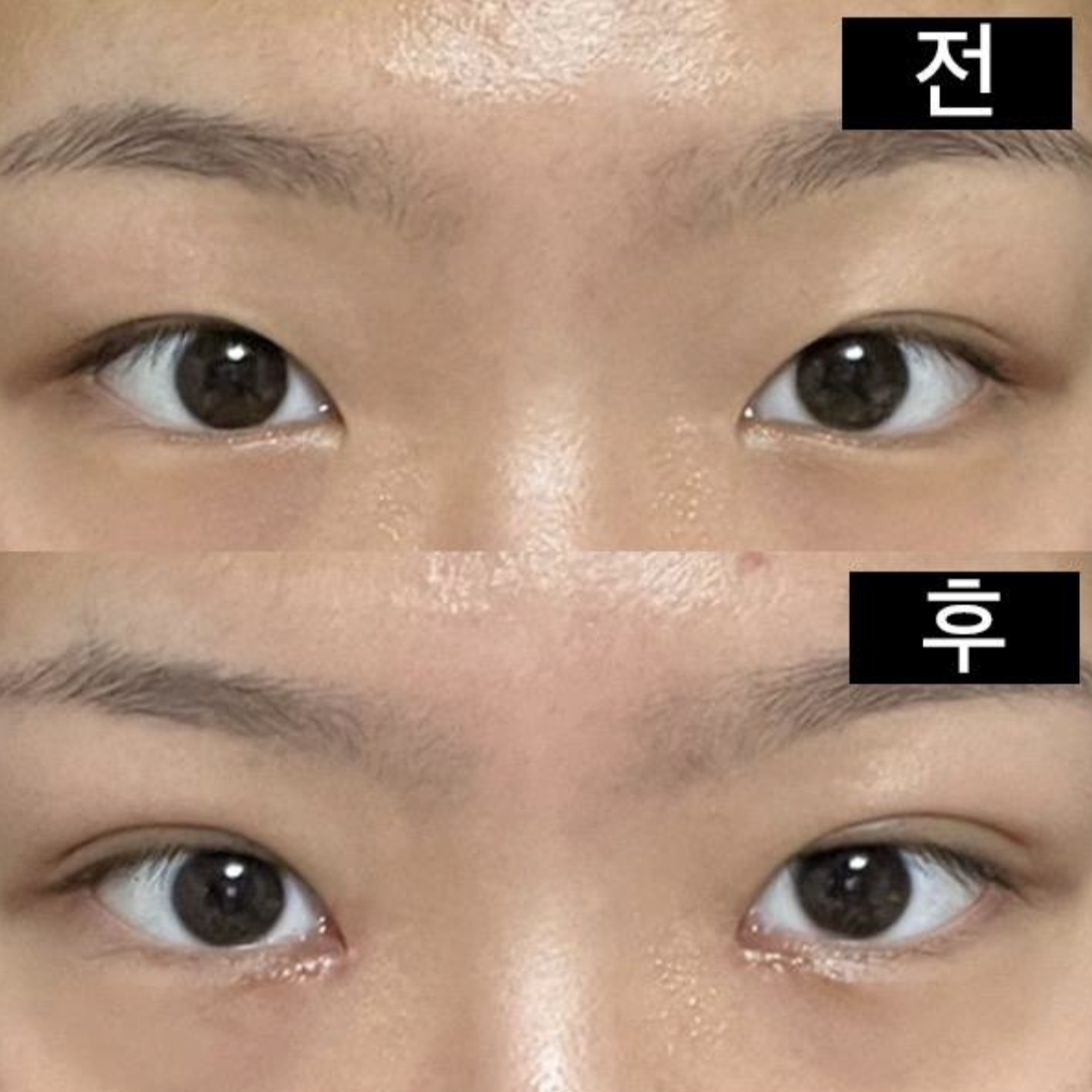 Өмнөх ба дараах бүх зургийг үндсэн камераар авсан!