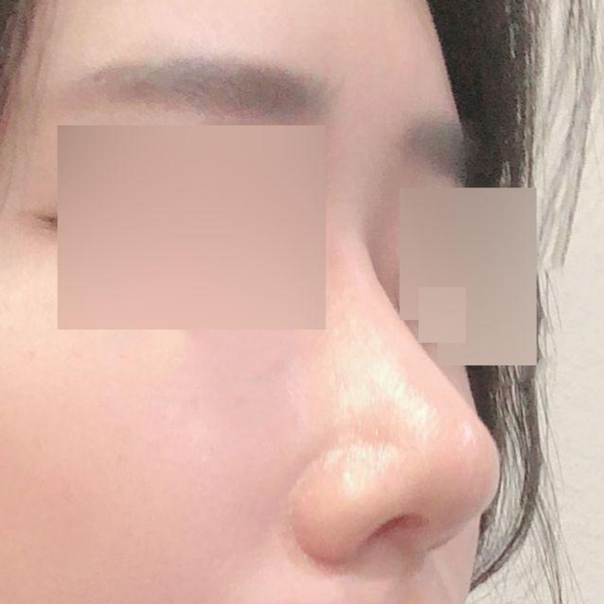 Миний хамар ургаад хагас жил болсны дараах сэтгэгдэл!