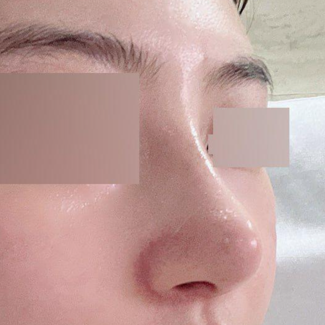 Миний хүссэн хамар хийлгэсэн Со Сын Жо эмчид баярлалаа!