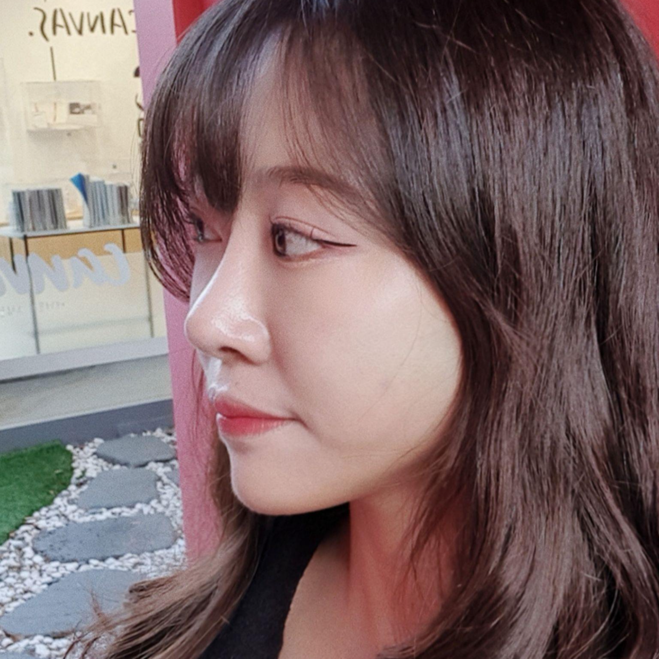 Хамрын дахин мэс засал хийлгэснээс хойш 6 сар боллоо