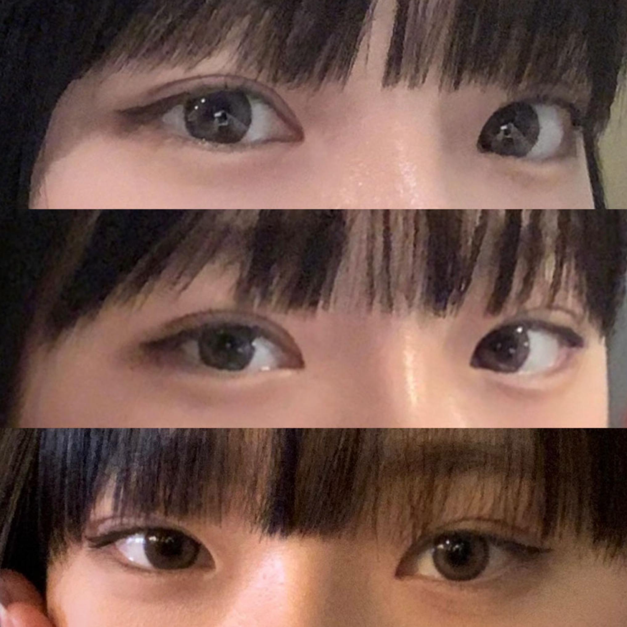 Нүдний дахин хагалгаа, хамрын хагалгаа хийлгэсэн!