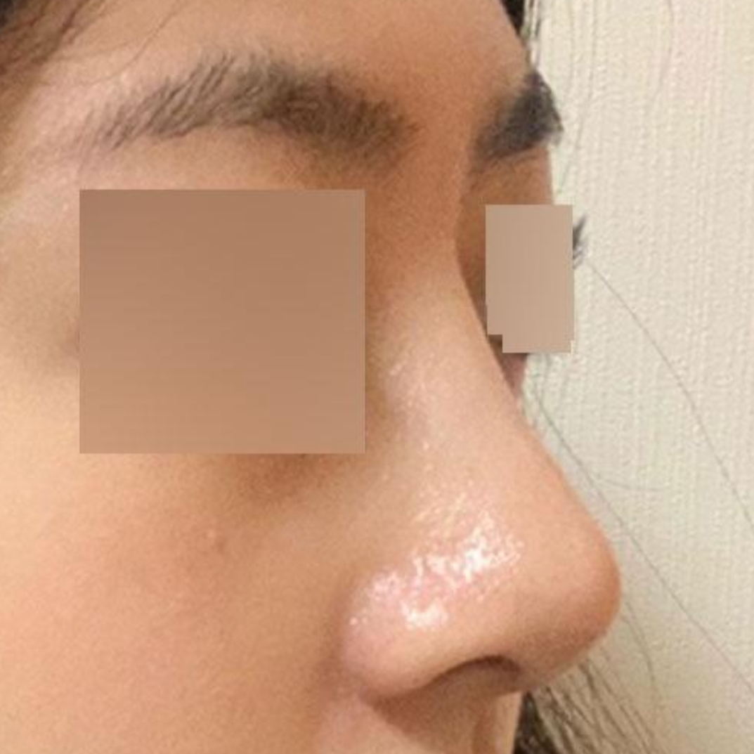 Доктор Со Сынжо-д хагалгаа хийлгэсний дараах нэг сарын дараах сэтгэгдэл.