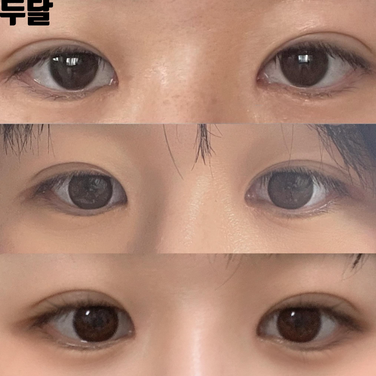 Сэтгэгдлээ үлдээж байна: Шим Жун Хван эмчид хамар, нүдний мэс засалд ороод хоёр сар болж байна