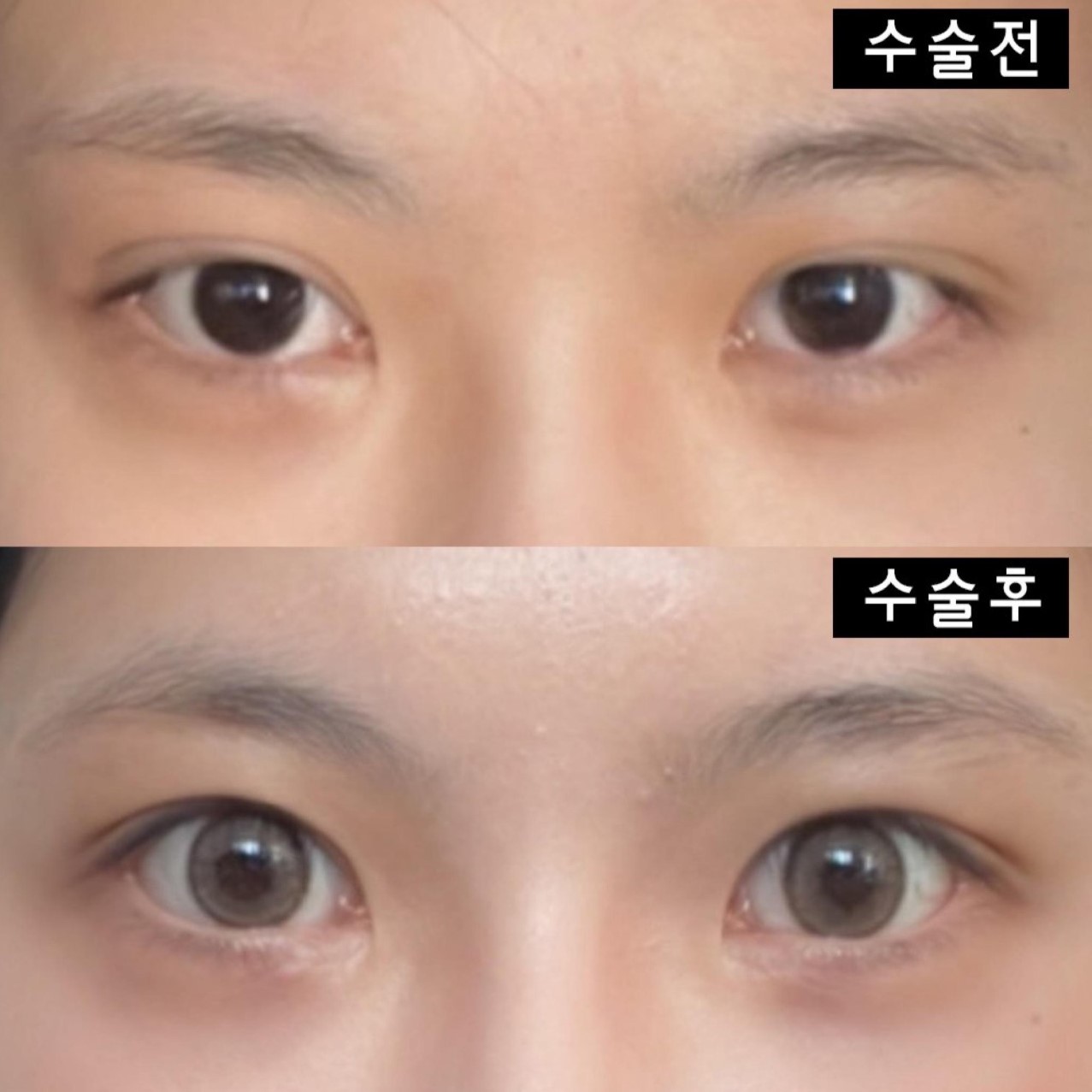 Виверс гоо сайхны мэс заслын эмнэлэгт хагалгаанд ороод хоёр сар болж байна даа ~