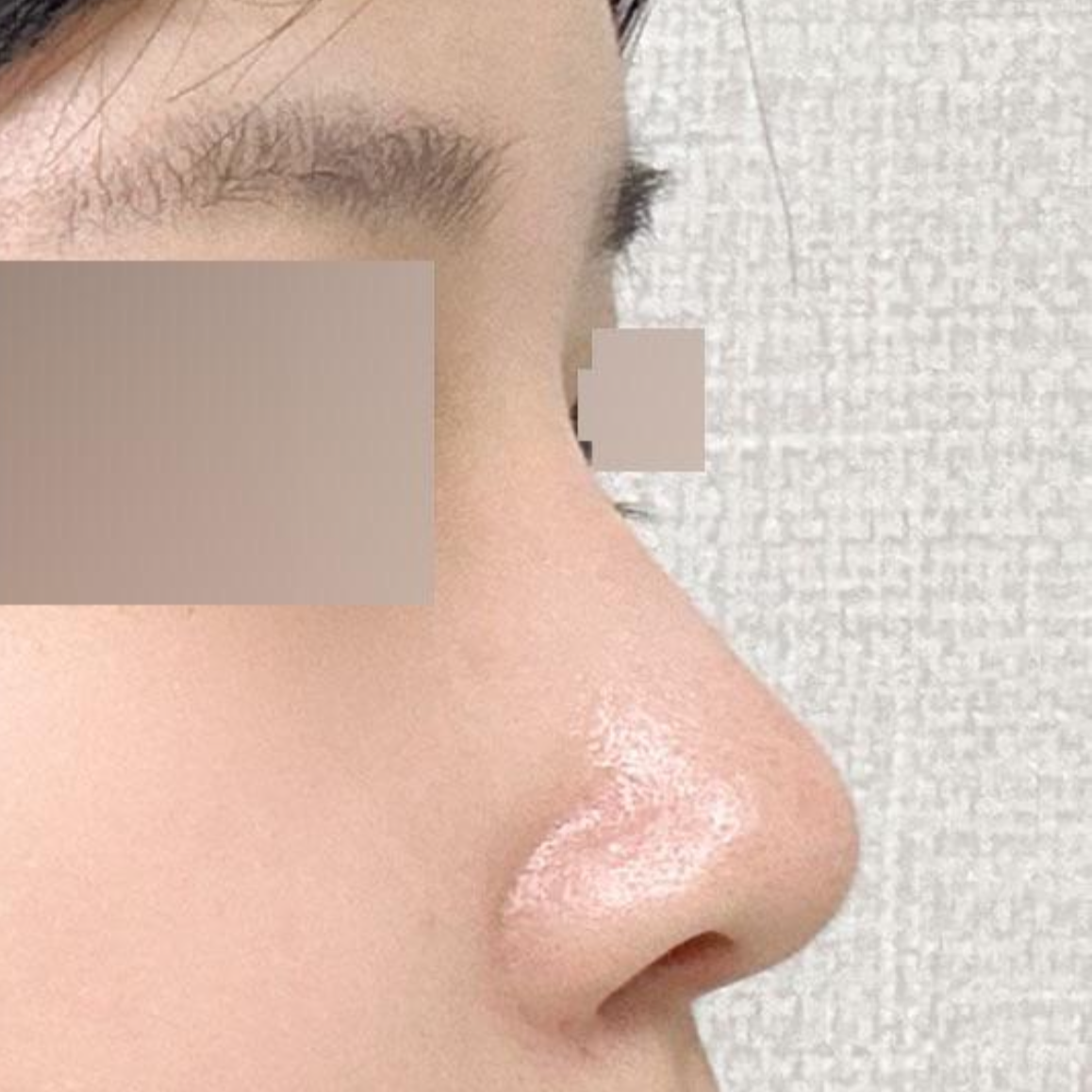 Вийверс гоо сайхны мэс заслын эмнэлэгт хагалгаанд ороод хоёр сар болж байна даа~