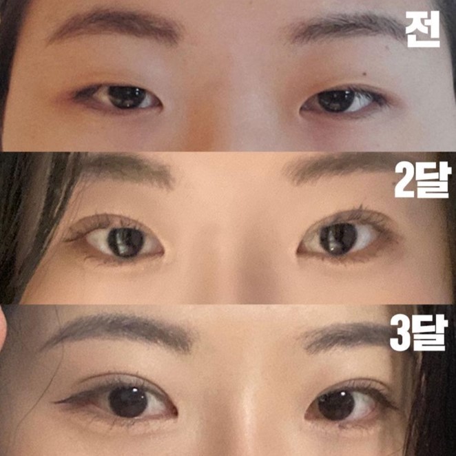 3 сар болчихлоо, үнэхээр гайхалтай харагдаж байна