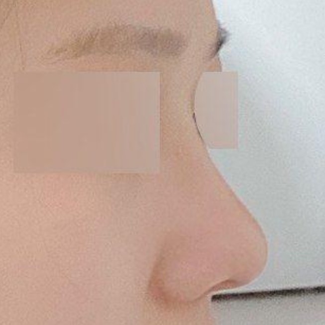 Хамрын нуруу гарч ирснээр хажуугийн төрх ч сайхан болж, эзэлхүүнтэй болсон!