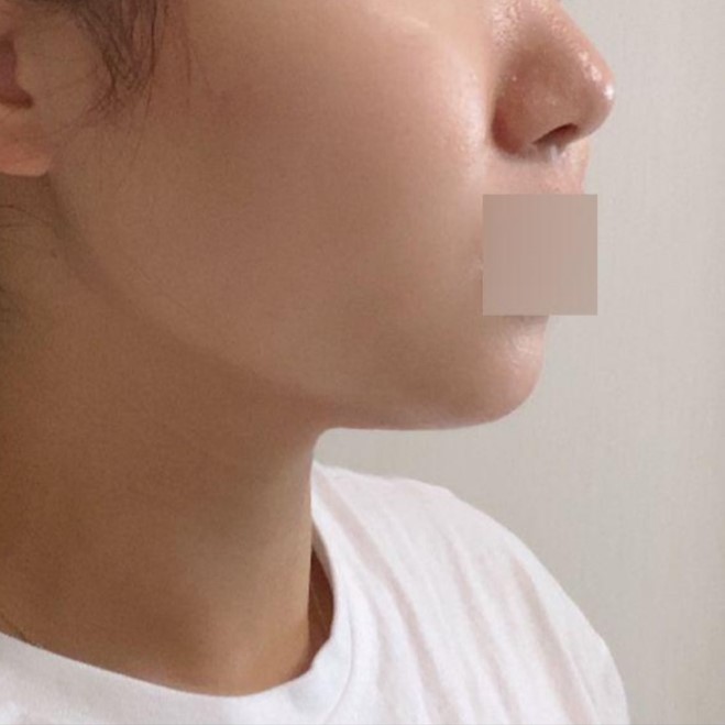 1 долоо хоногтой харьцуулахад эрүүний шугам улам хурц болсон нь харагдаж байгаа биз дээ.хэхэ