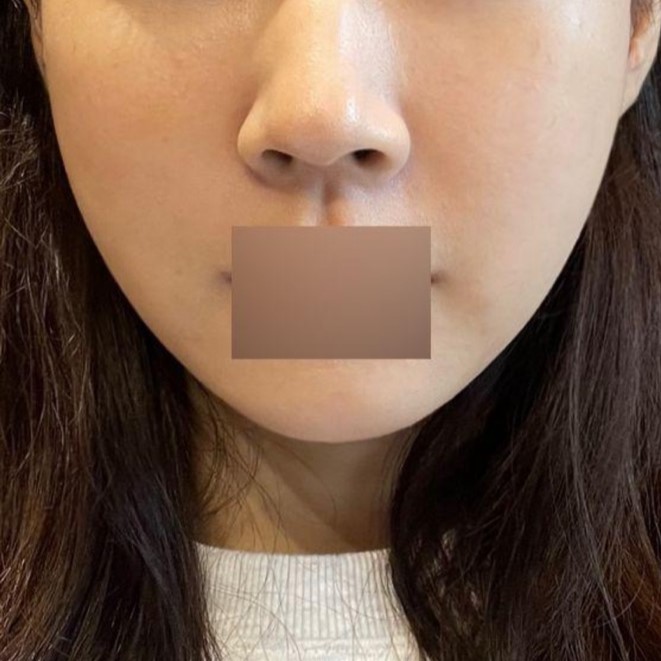 Энэ хэмжээгээр хавангүй байгаа нь гайгүй санагдаж байна