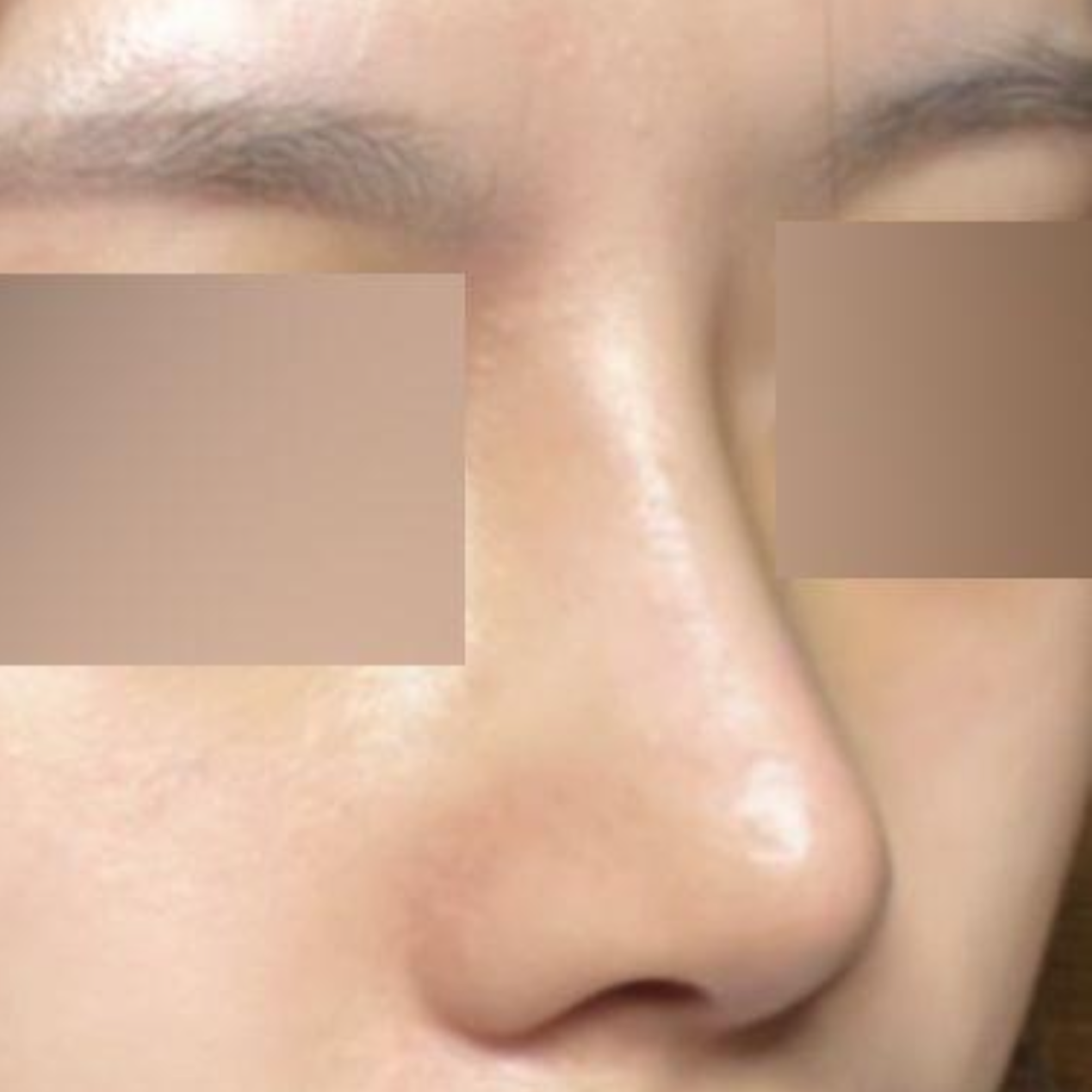 Анхны мэс засал боловч амжилттай болсон мэдрэмж илүү байна