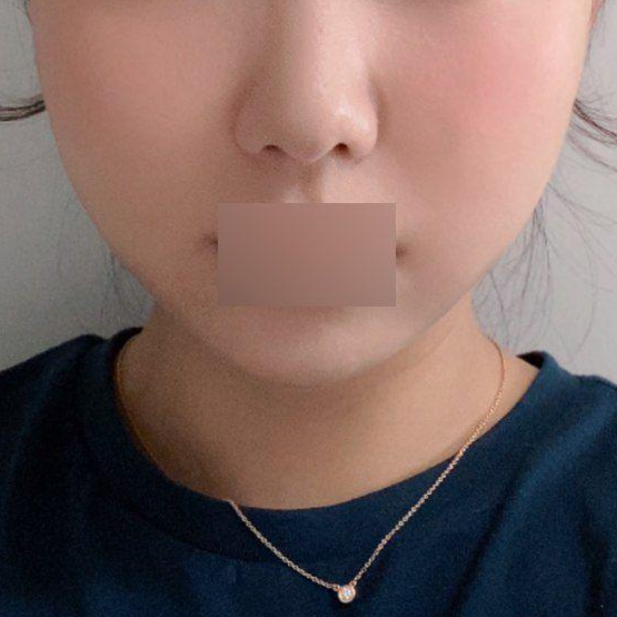 Шим Жун Хван эмчид утас татуулаад 1 сар боллоо