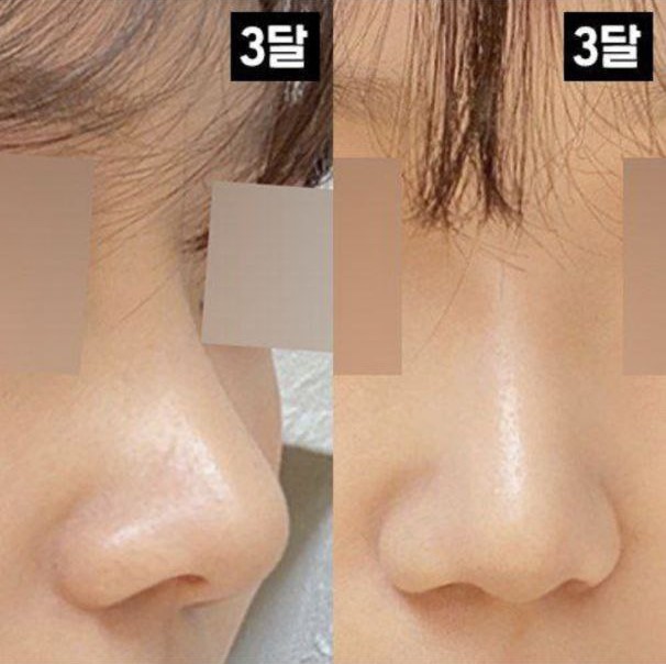 Хамарны нуруу, үзүүр хоёр бүгд таалагдаж байна!