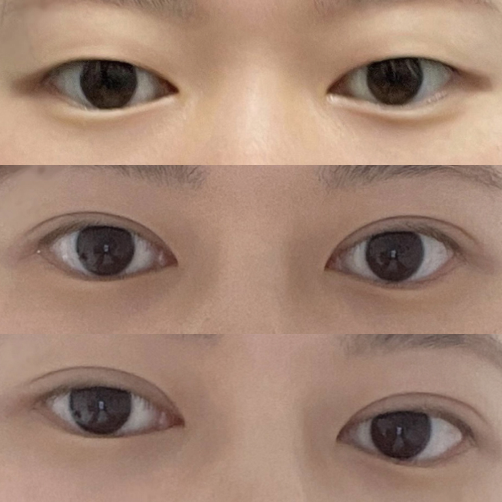 Зүсэлтээр нимгэн шугам гаргаж чадлаа