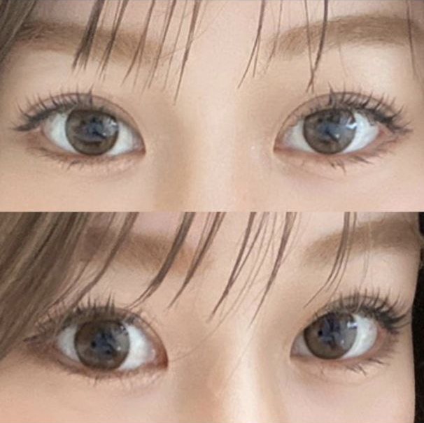 Хэт их эмчилгээ байхгүй, мэс засал хийсний дараа ч бүрэн сайн халамжилдаг шүүㅎㅎㅎ