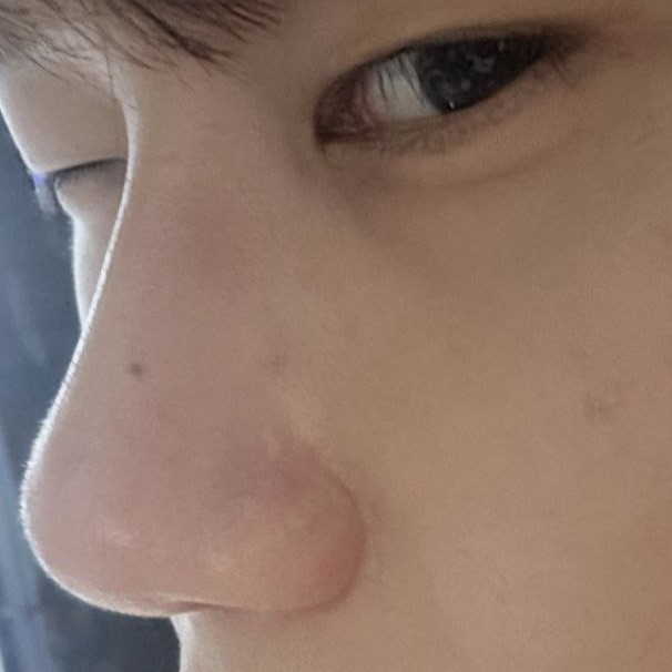 Мэс засал хийлгэсэндээ маш их баярлаж байна, баярлалаа