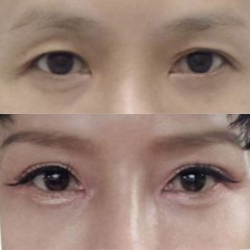 Хавагнах нь тэр дороо буурч, сайн болсон юм шиг байна