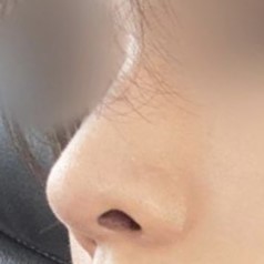 Хамрын мэс засал хийлгэсэн гэж мэдээгүй, маш байгалийн харагддаг гэж хүмүүс их хэлдэг.