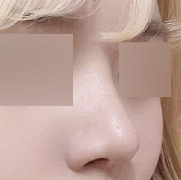 Хэрэв эмчид итгэх итгэл байхгүй бол хийлгэхгүй байсан байх даа kk