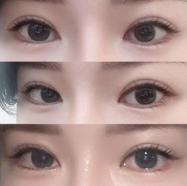 Хэрэв дахин мэс засал хийлгэх шаардлагатай бол бүгдээрээ Weverse-д очоорой!! ккк