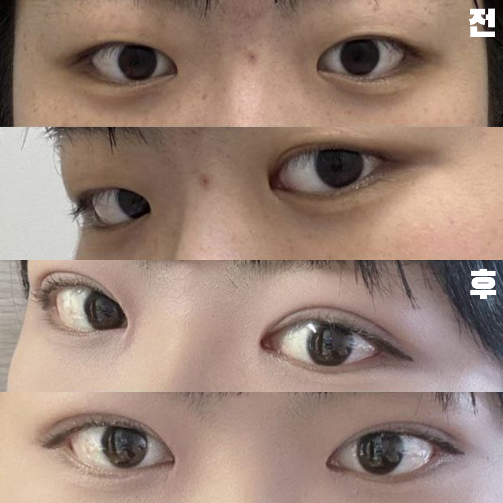 Өвдөлтгүйгээр нарийн хийж өгсөнд баярлалаа.